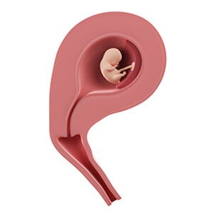 שבוע 10 להריון