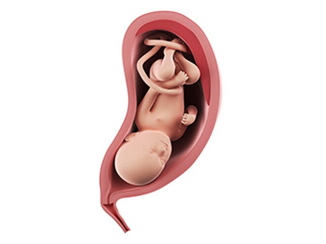 שבוע 34 להריון