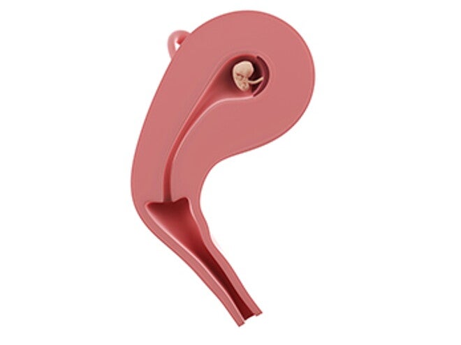 שבוע 8 להריון