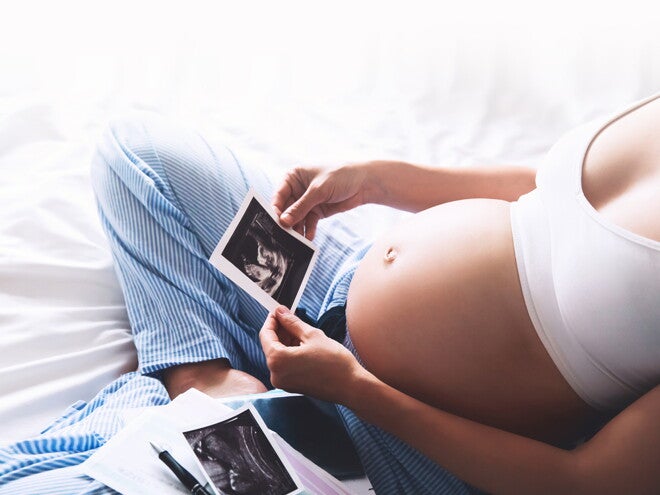אישה בהריון מחזיקה תמונת אולטרה סאונד